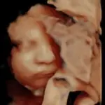 1000020340